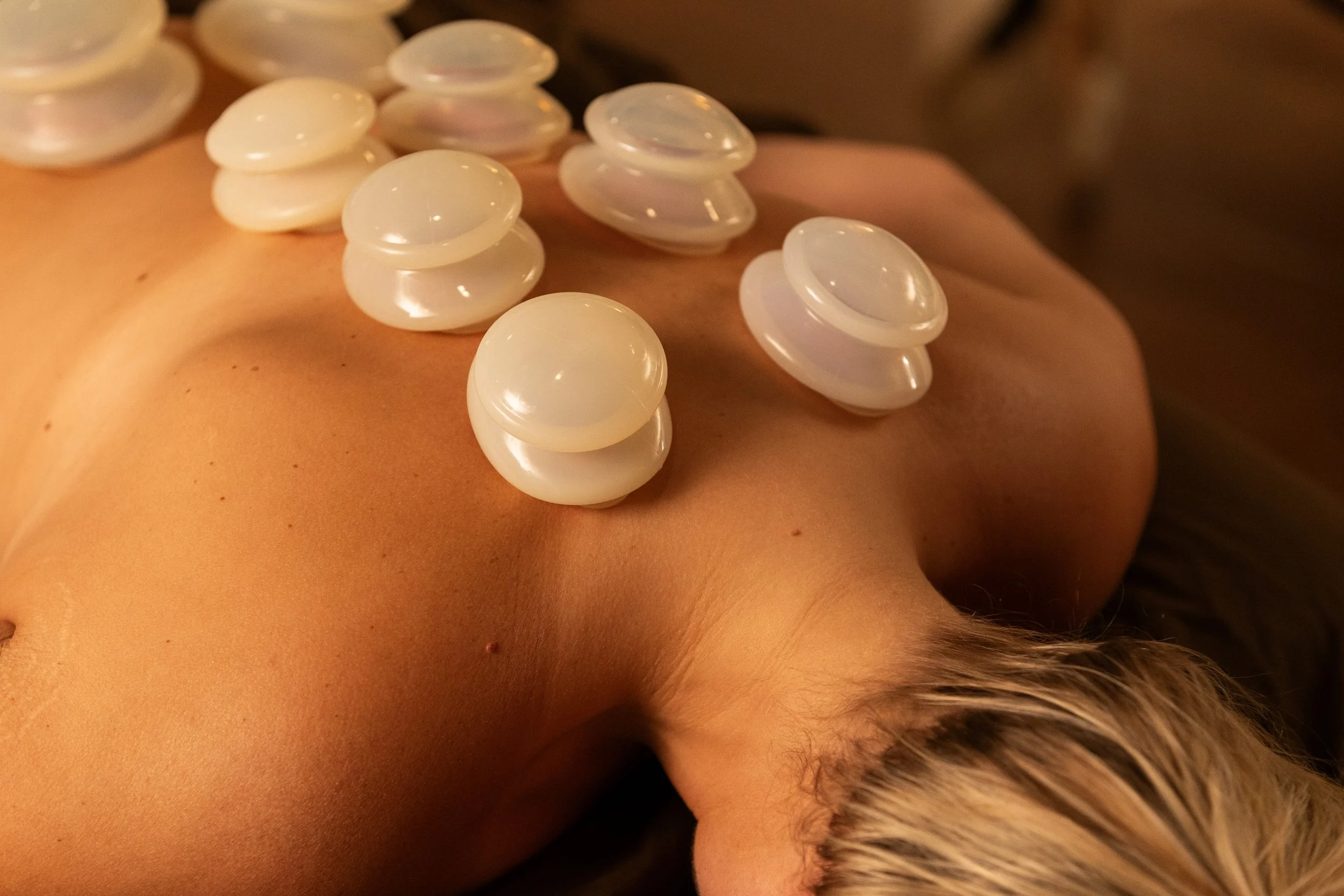 Silicone cups on a client's back during a cupping massage